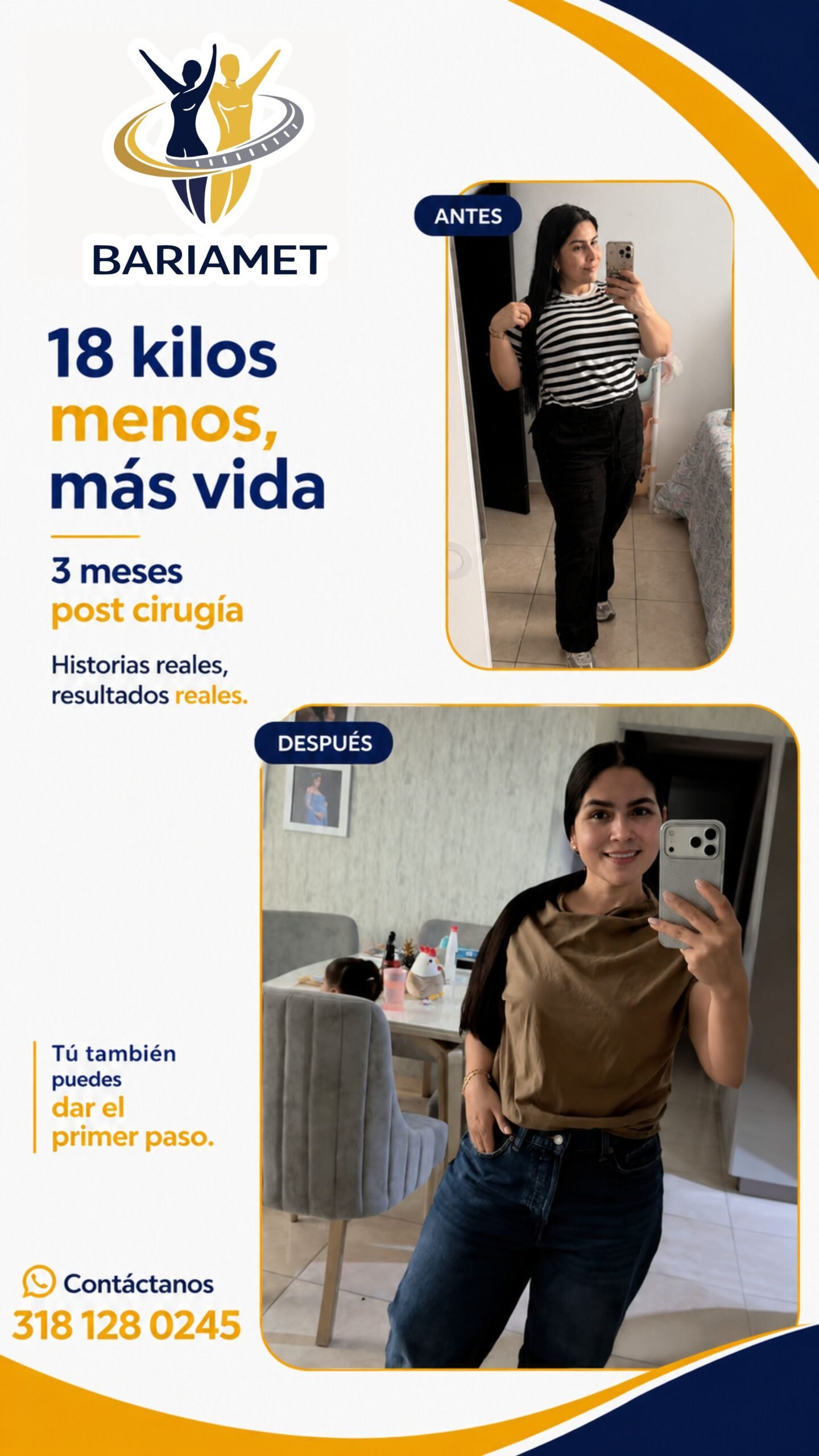 Transformación de paciente Bariamet