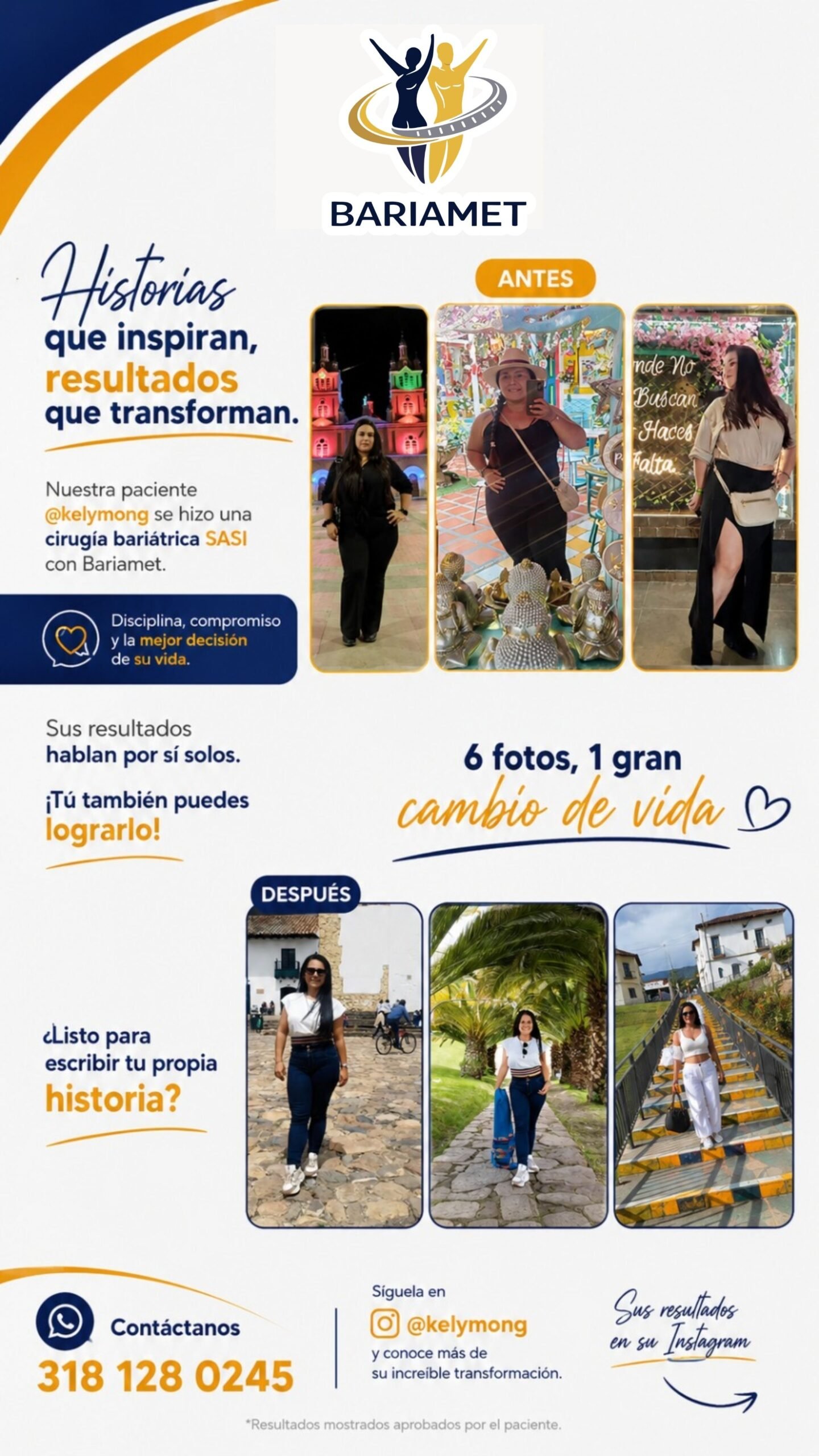 Transformación de paciente Bariamet